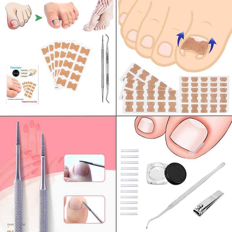 Ingrown Toenail Corrector Kit, 16PC Professional Ingrown Toenail Removal Kit with Correction Strips, Painless Treatment for Ingrown Toenail Pain Relief for Home Pedicure Care