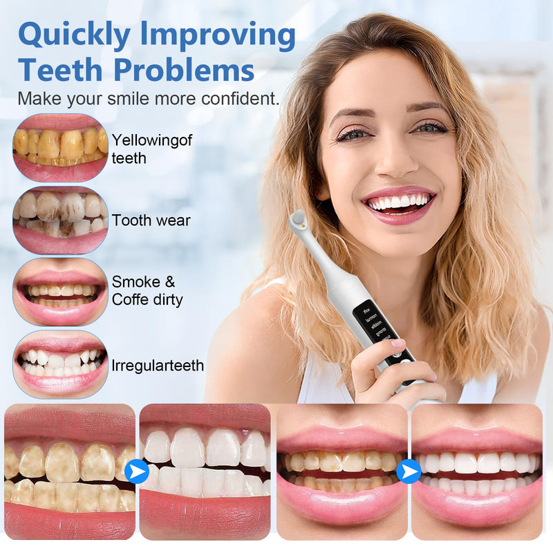 Teeth Polisher Kit: 6 Heads, 5 Speed Modes - for Teeth Cleaning Tools, Suitable for Daily Home Use,USB Rechargeable Teeth Whitening Kit with LED Light - BeesActive Australia
