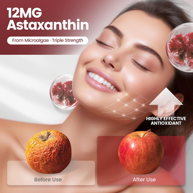 Astaxanthin 12mg, 240 Softgels, Fresh Haematococcus Pluvialis 10 in 1 Astaxanthin Antioxidant Supplements, Contains Lycopene, Grape Seed, Vitamin E, & More Supports Eye, Joints, Skin Health, 1 Bag Red: 1 Bag - BeesActive Australia
