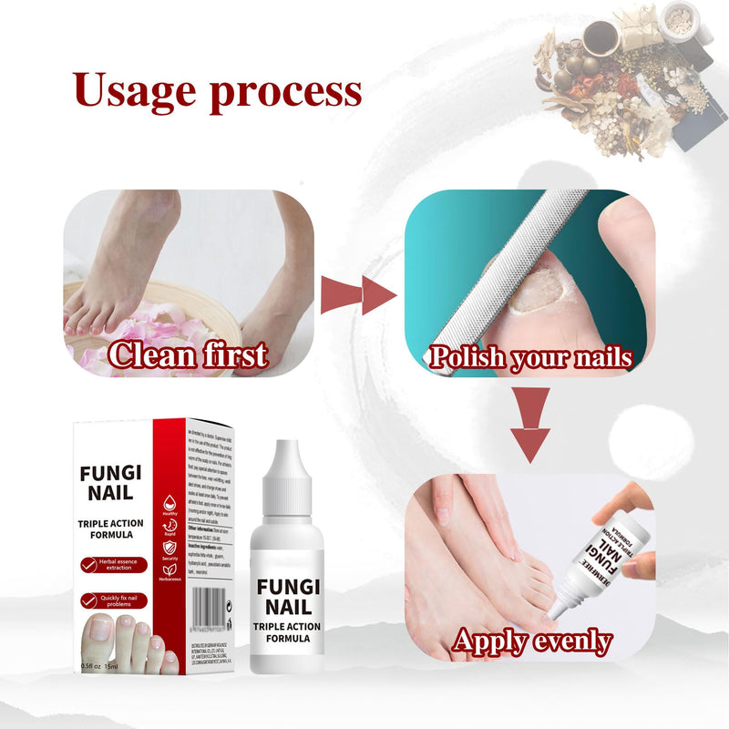 Toenail Fungus Treatment, Herbal Extracts, Nighttime Long-Lasting Nail Treatment, Suitable for Discoloration, Shaped Nails, Thick Nails, Safe and Gentle, Cuticle Care, 15ml/0.5oz (one) 0.5 Fl Oz (Pack of 1)