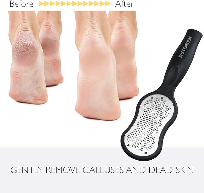 Heel File, Foot File Exfoliating Remover, Steinder Heel Exfoliator, Heel Sharpener, Micro Cutter, Washable OK, For Dry and Wet Feet with Cover, Safe, Hygienic, Clean Heels, Black, Large Size (Large) - BeesActive Australia