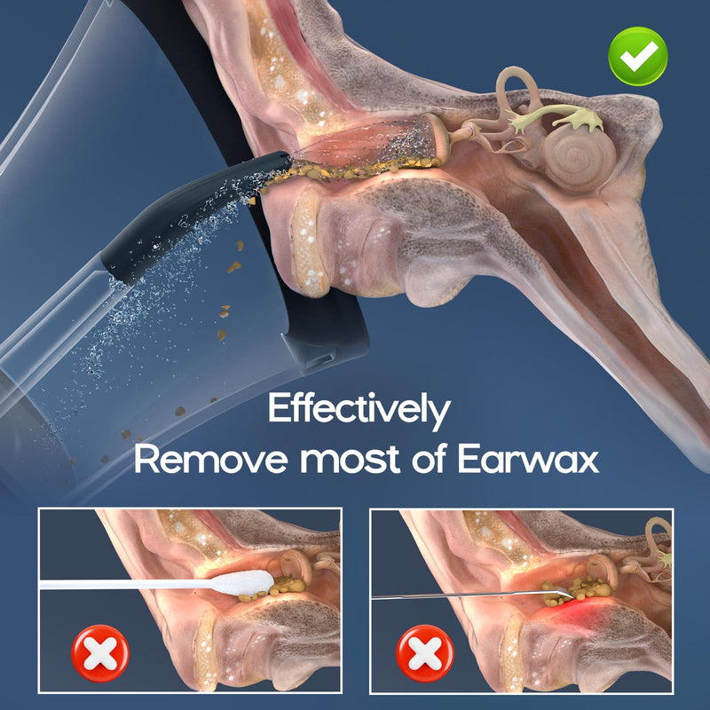Ear Wax Removal, Electric Ear Cleaning Kit Effective & Safe Ear Cleaner Irrigation Flushing System 4 Pressure Modes for Ear Wax Buildup, Water Resistant Ear Cleaning Tool USB Rechargeable Black