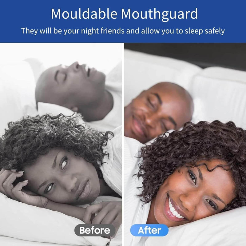Mouth Guard for Clenching Teeth at Night, Night Guards for Teeth Grinding, Mouth Guard for Grinding Teeth at Night, Reusable Teeth Grinding Mouth Guard, Mouthguards for Grinding of Teeth (4 Piece Set) - BeesActive Australia