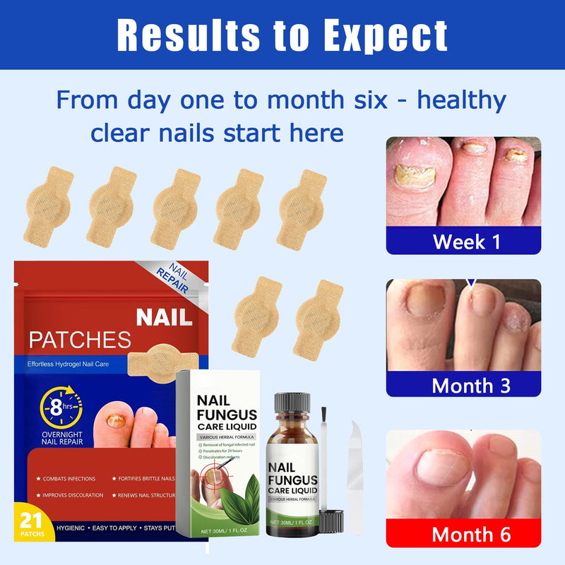 Fungal Nail Patches, 7 Days Nail 𝐅𝐮𝐧𝐠𝐮𝐬 Treatment, Toenail Treatment Patches Extra Strength - 100% Pure Natural Plant extract Repair for Damaged Nails, Kerasal Toenail