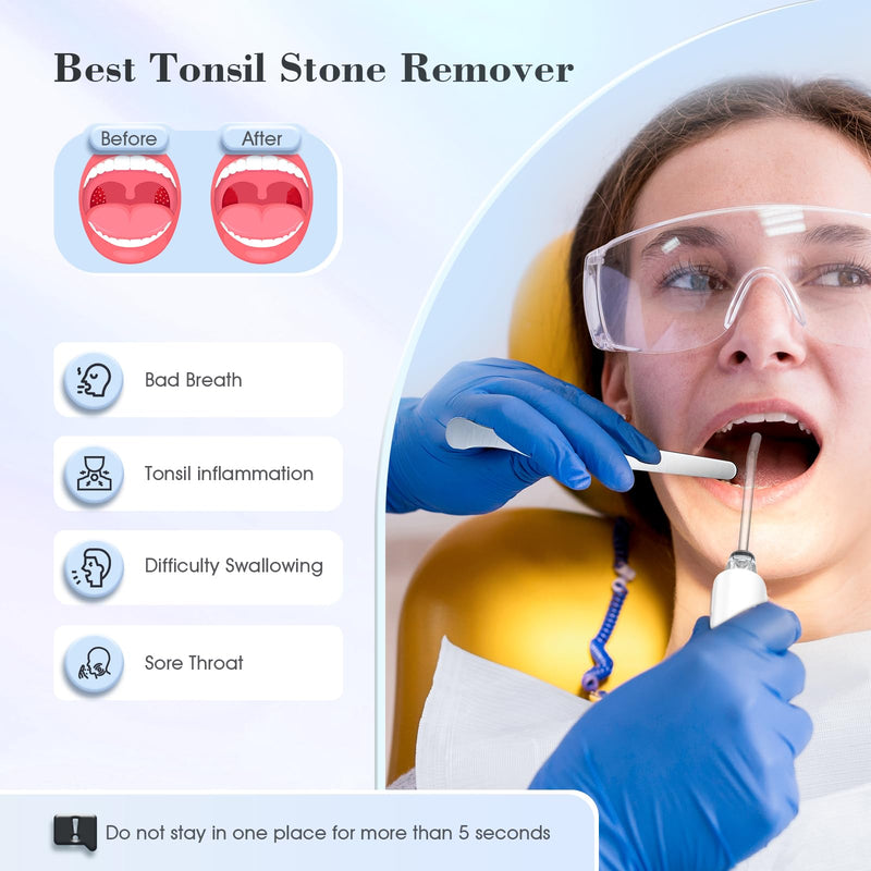 Tonsil Stone Remover Kit,3 Modes Electronic Tonsil Stone Remover Vacuum,Oral Irrigator for Best Tonsil Stone Remover LED Light,Tonsil Stone Mouthwash 5X Magnifying Mirror,Fight Bad Breath Tonsil Stone - BeesActive Australia