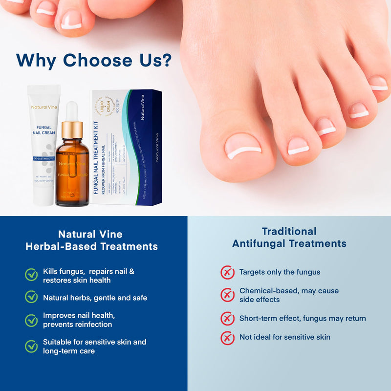 Natural Vine Toenail Fungus Treatment: Fungus Nail Treatment Liquid 15mL and Anti-fungal Nail Repair Cream 20g for Toenail and Fingernails - Extra Strength with Plant Extract Ingredients