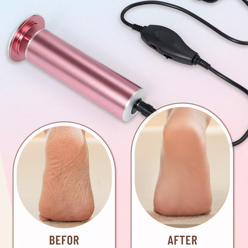 Dermawave Electric Foot File Callus Remover for Feet, Professional Electric Foot Sander Filer Grinder with 60 Sandpaper Discs for Men & Women, Pedicure Tool for Corn Dead Skin Cracked Heel Pink - BeesActive Australia