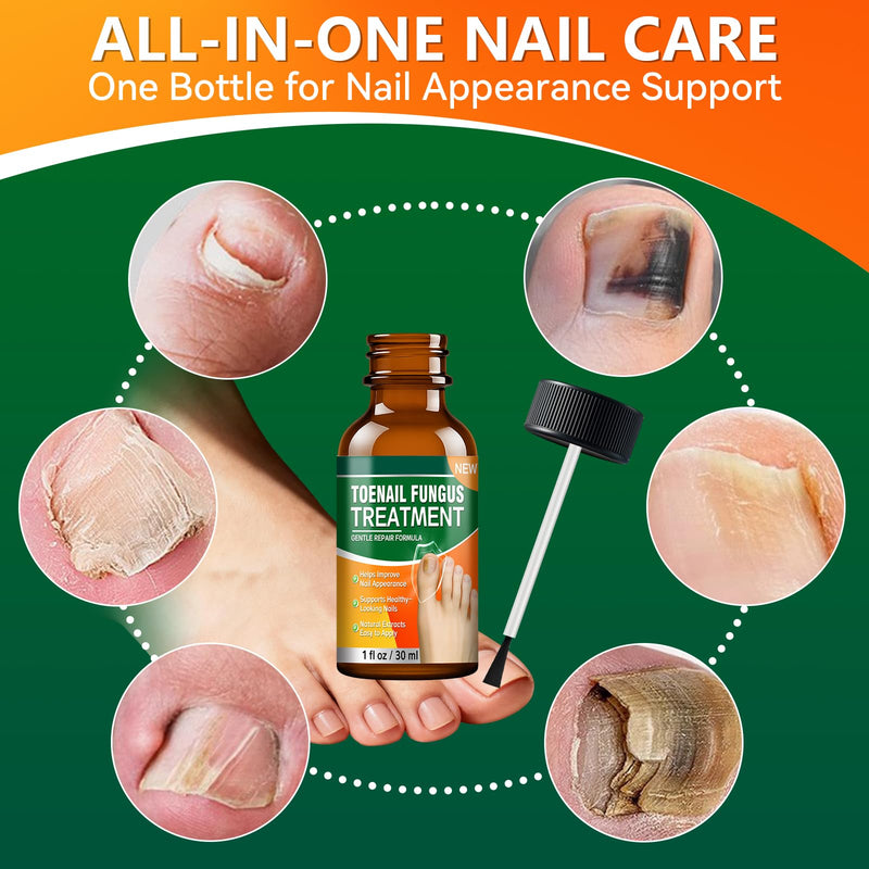 Toenail Fungus Treatment Extra Strength, Nail Repair Solution with Tea Tree Oil, Menthol, Vitamin E & Pro-Vitamin B5, Gentle Care for Damaged, Discolored, and Brittle Nails, 1 fl oz - BeesActive Australia