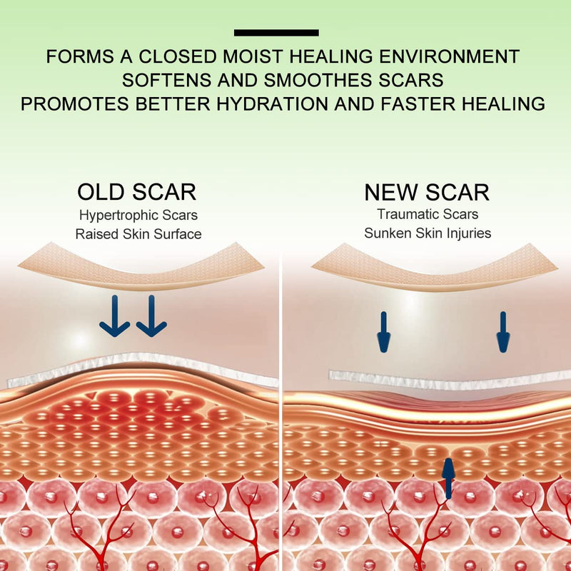 Silicone Scar Sheets(1.8‚Äù x 157‚ÄùInch- 4M), Scar Tape, Scar Strips, Medical Grade, Scar Remover, C-Section, Surgery, Keloid, Tummy Tuck, Scar Patch. - BeesActive Australia