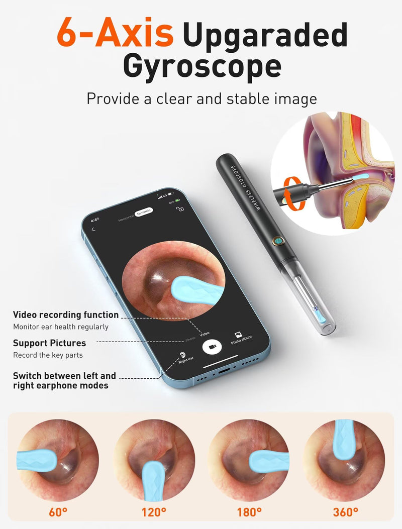 Ear Wax Removal Tool Camera - Ear Cleaner with 1080P HD Camera, FSA HSA Store Eligible, Otoscope with Light, Earwax Removal Kit with 50 Replacement Tips for iPhone, iPad, Android Phones (Black) Black - BeesActive Australia
