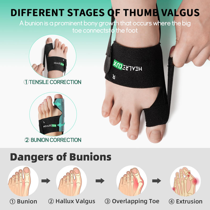 Healrecux Bunion Corrector for Women Men, Bunion Splint Brace Hallux Valgus Correction Big Toe Straightener for Daily Use, 1 Pair