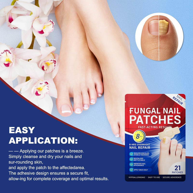 Toenail Fungus Treatment Extra Strength - 42 Pcs Fungal Nail Patches, nail repair patches-8-Hour Firm Adhesion, Nail Repair patches for Damaged Nails, Overnight Renewal for Men and Women 1.82 Ounce (Pack of 2) - BeesActive Australia