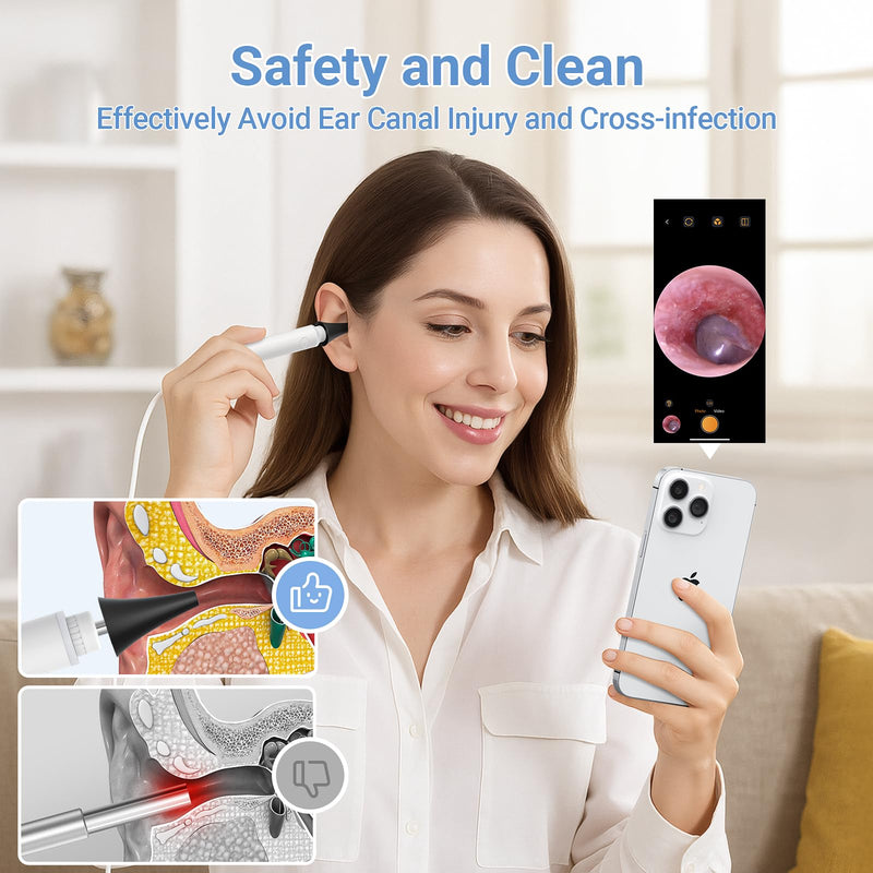 ScopeAround Otoscope with Light, 720P HD Ear Cleaning Camera & 6 LED Lights Ear Scope, Digital Otoscope with Camera, Smart Endoscope, Plug & Play, USB-C Port - BeesActive Australia