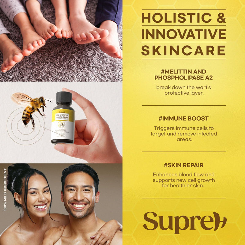 SupreH Bee Venom Wart Remover Kit: Maximum Strength Bee Venom Wart Solution with Botanical Skin Restore Cream - for Plantar and Common Wart 30 21 ML - BeesActive Australia
