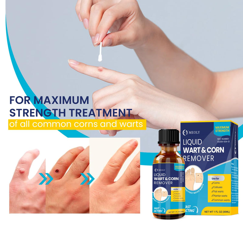 Salicylic Wart Removal Freeze Away: Fast-Acting Wart Removal Maximum Strength for Men and Women - Plantar Wart Genital Wart Corns Calluses 30 ML 1 Ounce - BeesActive Australia