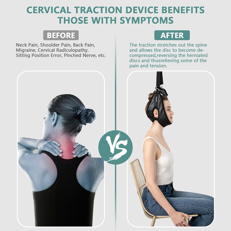 Neck Traction Device for Home Use, Portable Neck Stretcher Neck Hammock for Neck Pain, Over The Door Cervical Traction Device for Neck Decompression, Spine Stretching, Home Physical Therapy - BeesActive Australia