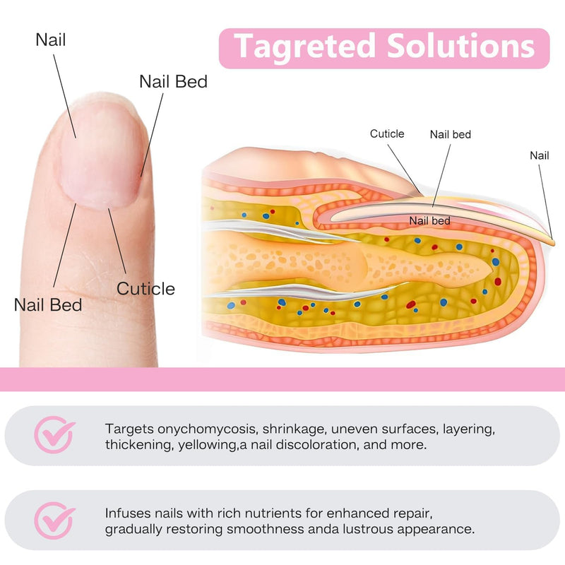 Fungal Nail Patches 60 Pcs – Extra Strength Hydrogel Treatment for Toenail Fungus, Upgraded Overnight Repair Nail Patches, 8-Hour Nighttime Nail Fungus Patches for Nail Fungus Treatment - BeesActive Australia