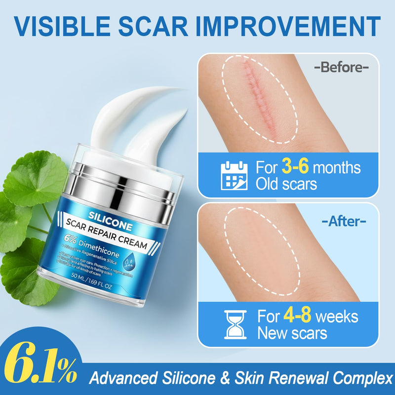 Scar Cream Advanced Silicone Cream for Scars Care Set, Scar Removal Cream for Keloid, Acne, Burns & Stretch Marks, Old and New Scars Soothing Softening, with Scar Tape, 1.69 fl.oz + 1.5m 1.69 Ounce (Pack of 1) - BeesActive Australia