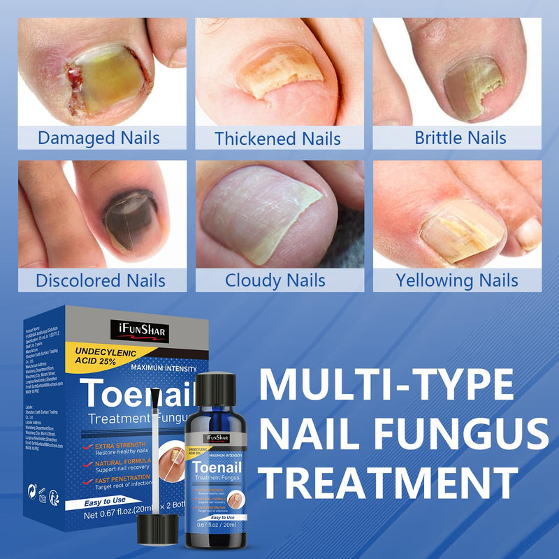 Toenail Fungus Treatment Extra Strength, Nail Fungus Treatment with 25% Undecylenic Acid, Upgraded Fungal Nail Repair for Yellow, Discolored, Thick and Ingrown Nails, 2 Bottles