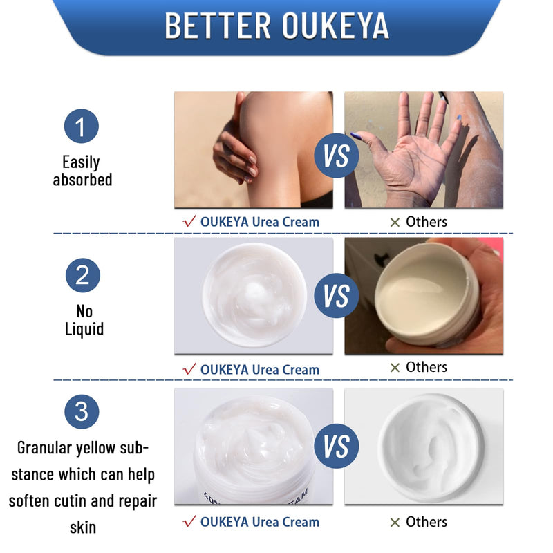 OUKEYA Urea Cream 40 Percent,Foot & Hand Cream for Dry Cracked,Urea Lotion for Feet Maximum Strength 5.29Oz-1P