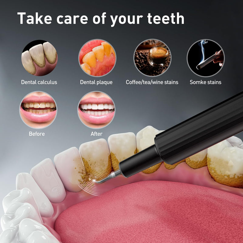 Plaque Remover for Teeth - Tartar Remover for Teeth, Dental Calculus Remover Teeth Cleaning Kit 4 Speed Modes with 4 Replaceable Heads, IPX6 Waterproof with LED Light