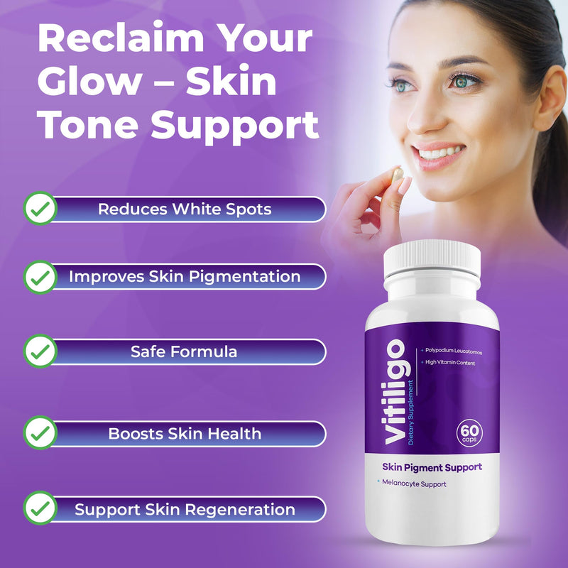 Vitiligo Capsules 60 Count | 1 Month | Improve Skin Pigmentation Support and Reduce White Spots | Effective Vitiligo Supplement | Natural Solution for White Spots on Skin. (3) 3