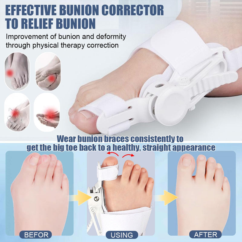 Bunion Corrector for Women & Men - Adjustable Nighttime Big Toe Straightener Bunions Splint with ABS Support for Hallux Valgus Relief Hammer Toe Brace Sleeping Home Use Left/Right Feet - 1PC Grey