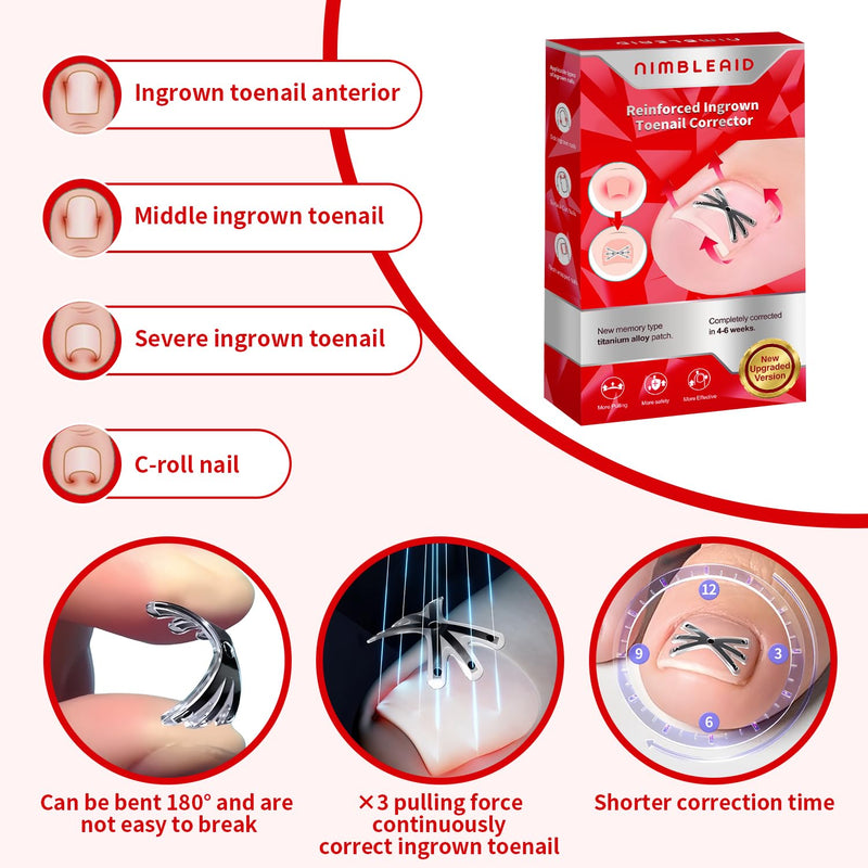 Upgraded Titanium Alloy Ingrown Toenail Corrector with Upgraded 6-Angle Shape,3x Stronger Pull Force,Ingrown Toenail Removal Kit, Ingrown Toenail Treatment for Women and Man (Small size) 1 Count (Pack of 14) - BeesActive Australia