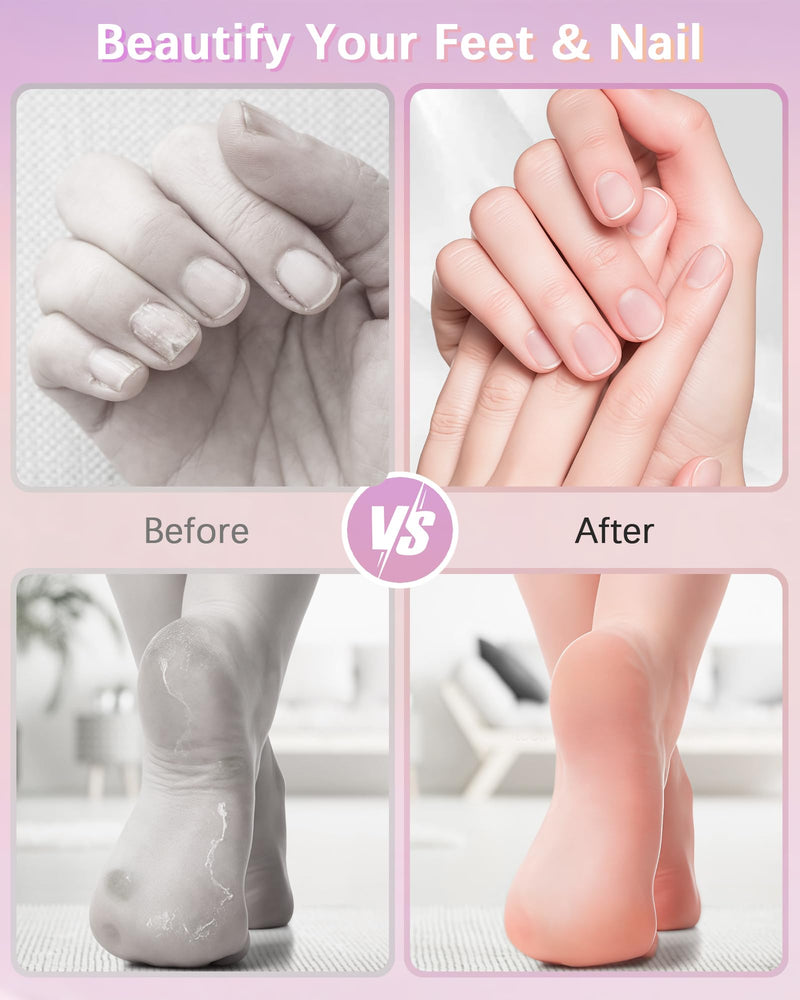 2 in 1 Electric Foot Callus Remover, 9 Adjustable Speeds Foot Scrubber USB Rechargeable Pedicure Tools for Feet, Dry Dead Skin Scraper Foot Grinder with 80/120 Grit Sandpaper Discs Rollers for Women Pink Gradient - BeesActive Australia