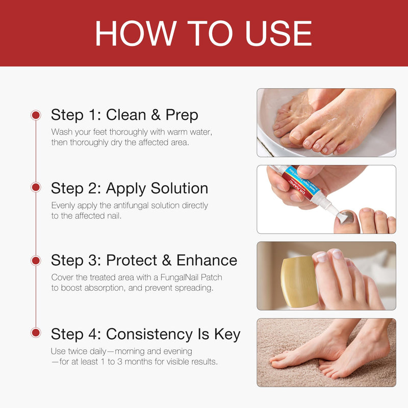 Toenail Fungus Treatment Extra Strength - Toenail Fungus Treatment Pen & Fungal Nail Patches, Day and Night Fungal Nail Treatment Set Ideal for Nail Repair for Damaged Nails Toenail Fungus - BeesActive Australia