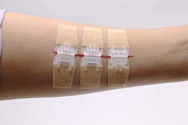 Emergency Laceration Closure Kit for Lacerations and Cuts, 10 Piece Set