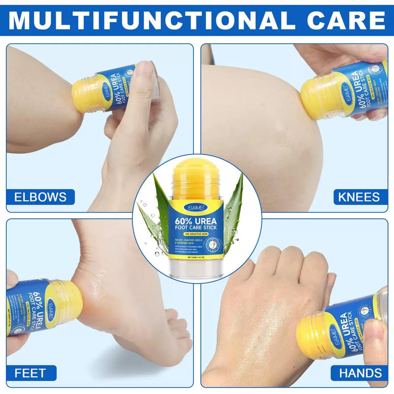 60% Urea Cream Stick plus 2% Salicylic Acid, Maximum Strength Urea Foot Cream Callus Remover for Dry Cracked Heels, Hands, Knees,Exfoliating Moisturizer, Dead Skin Remover Foot Balm 1.4oz (1 pack) 1 pack