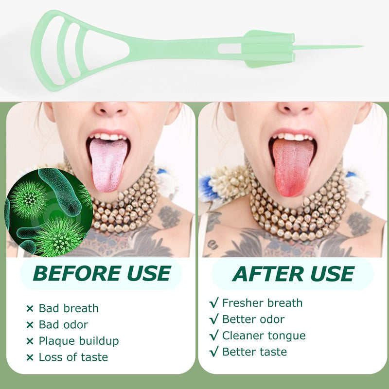 100 Counts Disposable Tongue Scraper with Dental Picks, Plastic Tongue Scrubber,BPA Free Tongue Cleaner Scrapers, Reduce Bad Breath and Fresh Breath(Green) 100 Counts,Green Tongue Scrapers