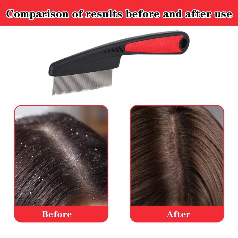 AOZUO Pack of 2 flea combs for cats, flea combs, dogs, cat comb, dandruff comb made of stainless steel, wide fine teeth, lice combs, professional scalp care tool, multifunctional anti-static skewer comb - BeesActive Australia