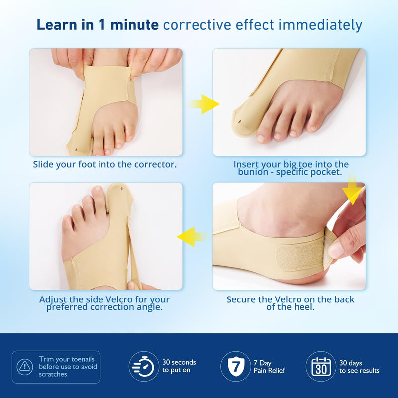 2 Pcs Bunion Corrector & Adjustable Toe Spacer for Women & Men-Big Toe Support with Side & Heel Straps, Hallux Valgus Pain Relief, Comfortable for Day & Night. (2, Beige, M) 1 - BeesActive Australia