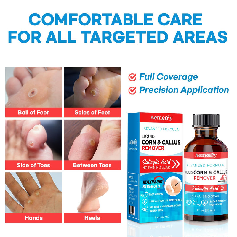 Corn Removers for Toes Foot: Liquid Salicylic Acid 17% Corns Calluses Removal Extra Strength, Fast Acting Corn Remover for Feet Fingers. 30ml Vanilla 1 Ounce - BeesActive Australia