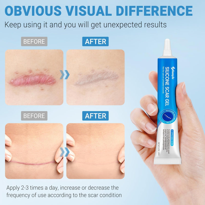 Silicone Scar Gel, Scar Cream, Advanced Scar Stick for Surgical Scars, Stretch Marks, Keloid Bump Removal, Old and New Scars 0.70oz (20g) 0.7 Ounce