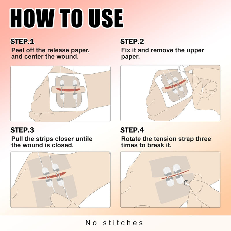 Carbou Emergency Wound Closure Strips, 4 Pcs Zip Stitch 2-Strap(4 Pcs)