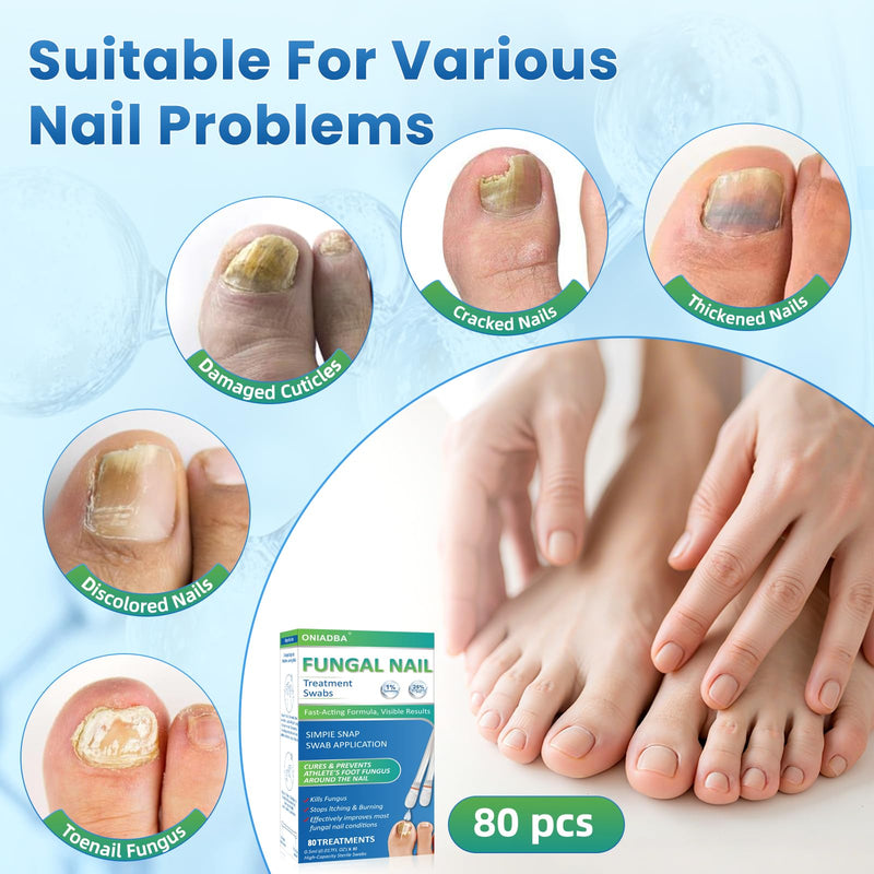 Fungal Nail Treatment Swabs–80 Ct, Extra Strength Toenail & Athlete’s Foot Fungus Treatment with 25% Undecylenic Acid, Damaged, Discolored & Thick Nails, Restores Healthy Nail Growth