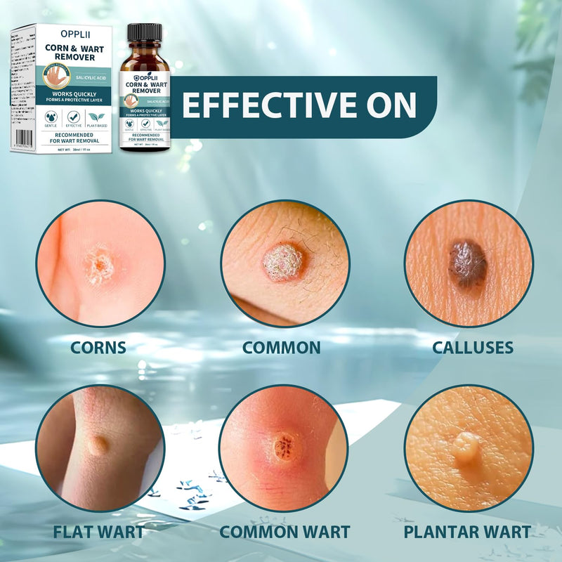 Wart Remover, Fast-Acting Removal for Men and Women,Strongest Wart Removal for Toes Feet - Exclusive Formula 17% Salicylic Acid Freeze Off for Plantar,Common, Flat Wart, 30ml - BeesActive Australia