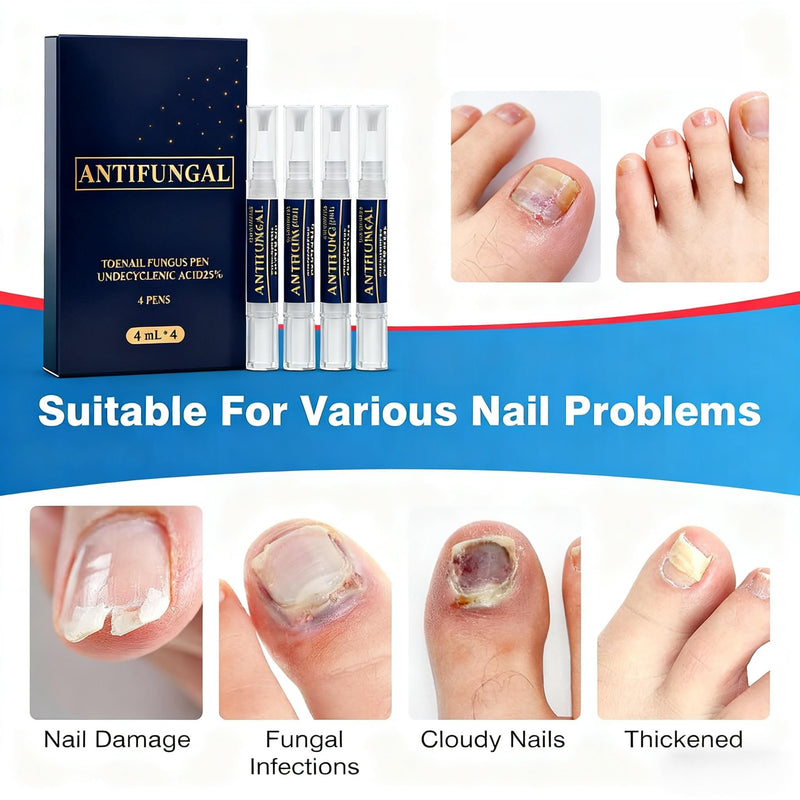 Toenail Fungi Treatment Extra Strength & Fungi Nail Pen - 4PC Fungi Nail Pen Repair for Damaged Nails,Targeted Solution for Nail Health Concerns (Athletes Ideal), 4ml/0.14FLOZ -2 Blue-3 - BeesActive Australia