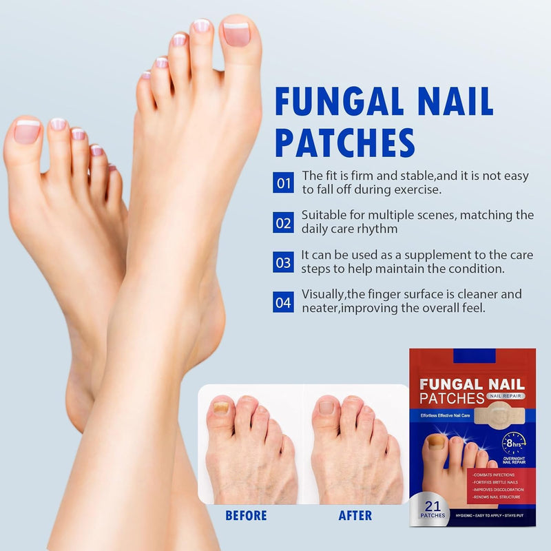 Nail Patches 21 PCS Toenail Treatment Extra Strength 8-Hour Overnight Nail Fast Acting Repair Effortless Hydrogel Nail Care and Repair for Damaged Nails Overnight Renewal for Men and Women 0 Ounce (Pack of 21)