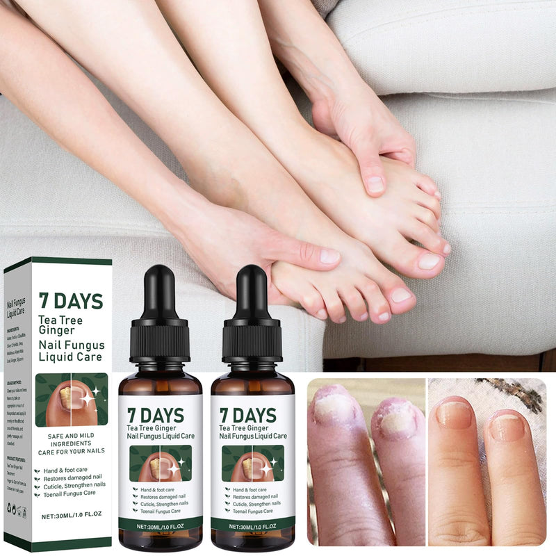 7 DAYS Tea Tree Ginger Nail Treatment, Clysburtuony Ginger Nail Growth Serum &30ml Liquid Serum with 20 Renewal Patches, Cuticle Care, 2-Pack (Standard-A) 0.5 Fl Oz (Pack of 2)