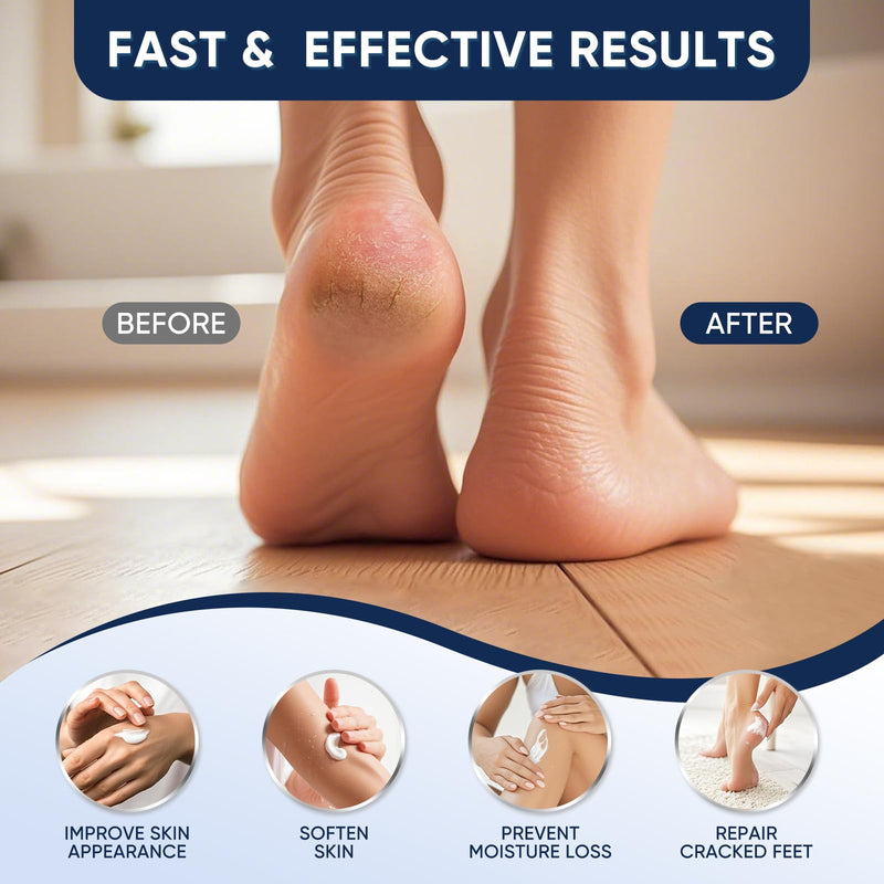 Urea Cream 40 Percent for Feet Maximum Strength, Urea Cream 40% Plus Salicylic Acid 2%, Foot & Hand Cream for Dry Cracked 40%