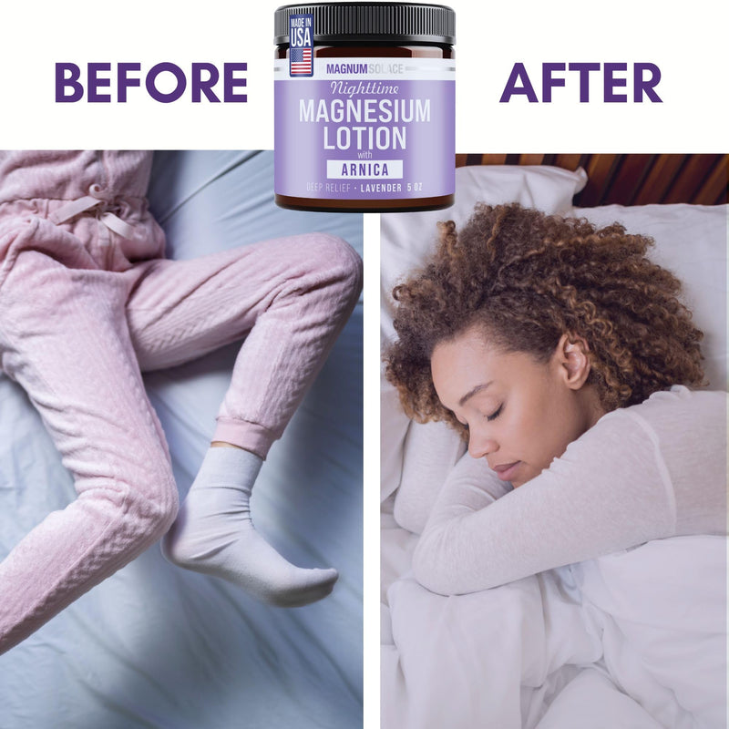 Magnum Solace Nighttime Magnesium Lotion with Arnica – Highly Concentrated Magnesium for Muscles & Joints – Apply to Legs or Feet Before Bed – Skin-Friendly - BeesActive Australia