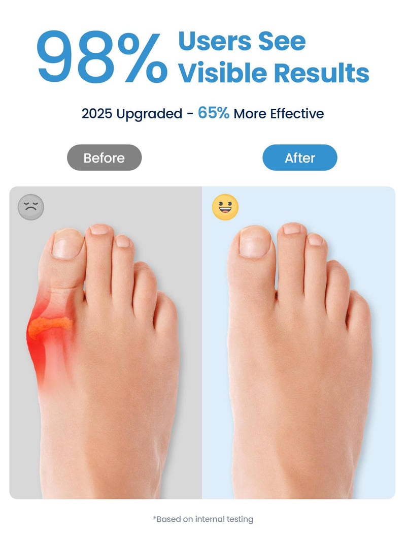 Bunion Corrector, Toe Separators for Women Men Big Toe, Toe Spacers, Bunion Correction, Breathable(4PCS) 4