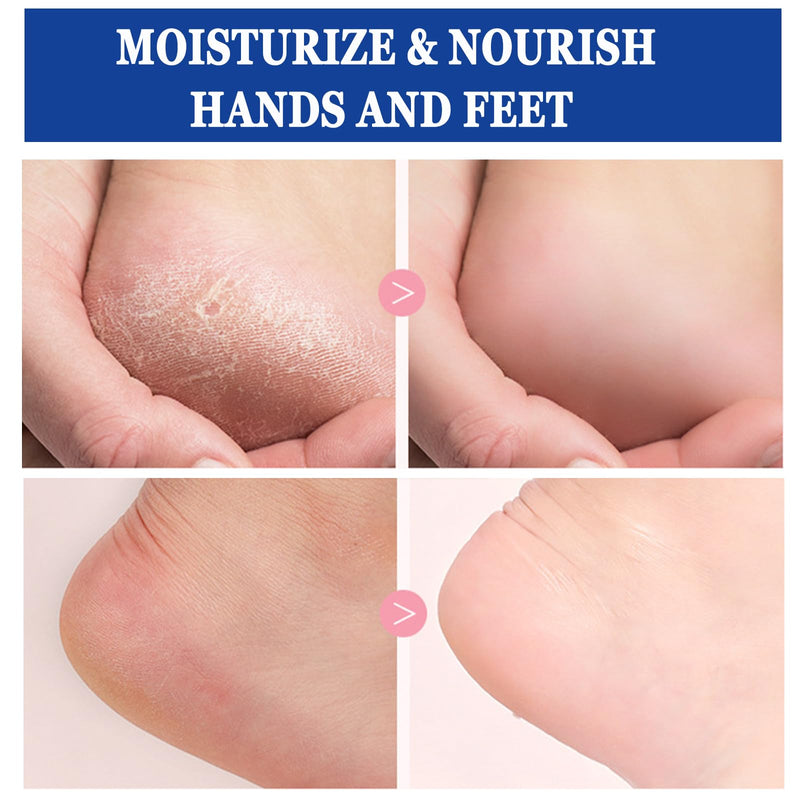 2PCS 60% Urea Cream plus 2% Salicylic Acid Foot Cream, Hydrating and Anti-Cracking Foot Cream, Maximum Strength Urea Foot cream Exfoliates Dead SkinRepairs and Hydrates Dry and Cracked Feet and Hand - BeesActive Australia