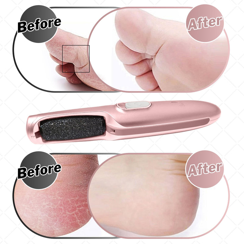 Powerful Electric Callus Remover Wand – Rechargeable Foot File, Grinder & Scrubber - Removes Dead, Hard Skin & Calluses – Best Pedicure Tool for Soft, Smooth Feet for Men & Women (Rose Gold) Rose Gold - BeesActive Australia