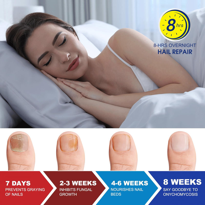 Toenail Fungus Treatment Extra Strength - 42 Pcs Fungal Nail Patches, nail repair patches-8-Hour Firm Adhesion, Nail Repair patches for Damaged Nails, Overnight Renewal for Men and Women 1.82 Ounce (Pack of 2) - BeesActive Australia