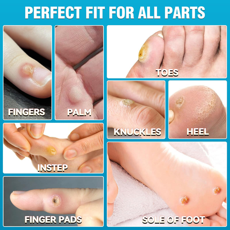 AstraVox 24Pcs Corn Removers for Toes Feet with Adhesive PU Waterproof Membrane, Plantar Corn Remover Bandaid Pads Kit for Hand, Highly Effective, Pain Relief, Easy to Use (Large) Large - BeesActive Australia
